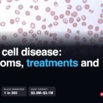 Blood smear with sickle-shaped red blood cells: sickle cell disease symptoms, treatments and costs