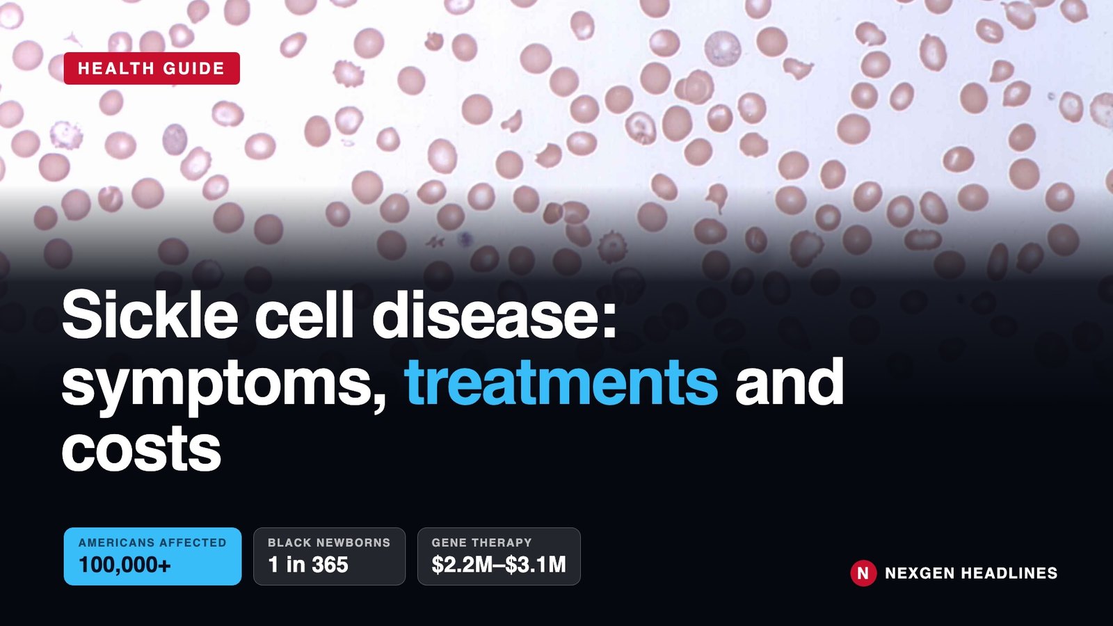 Blood smear with sickle-shaped red blood cells: sickle cell disease symptoms, treatments and costs